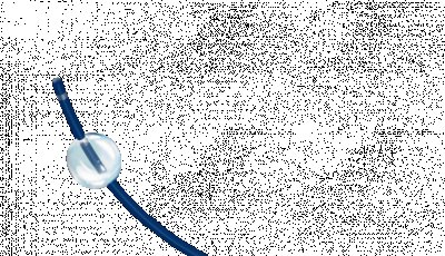 Introduction to Balloon Occlusion Microcatheters